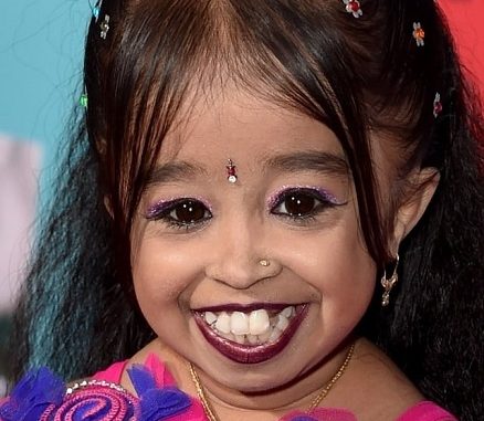 Did Jyoti Amge Have A Leg Surgery? Here Are The Photos