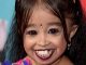 Did Jyoti Amge Have A Leg Surgery? Here Are The Photos
